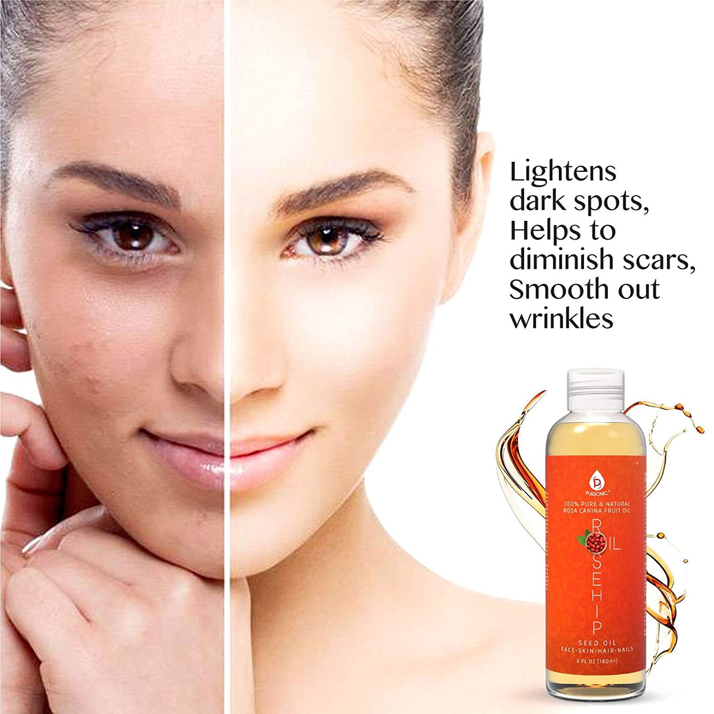 Pure & Natural Cold Pressed Premium Rosehip Seed Oil 6 Oz  -100%